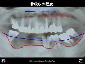 スライド1