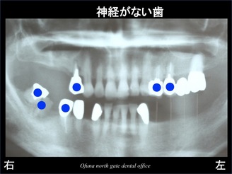 スライド09