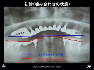 スライド03