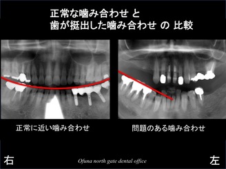 スライド06