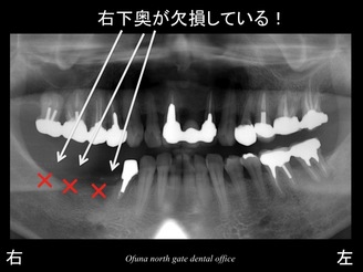 スライド02