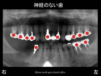 スライド06