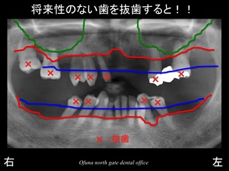 スライド09