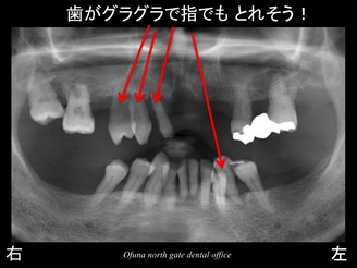 スライド02