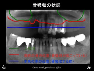 スライド06