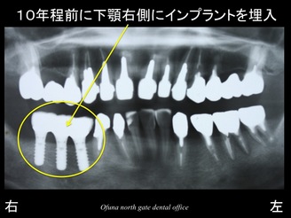 スライド02