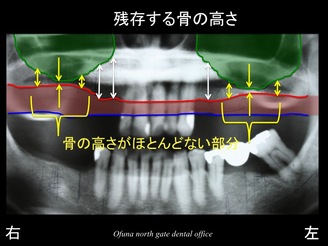 スライド08