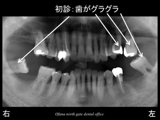 スライド06