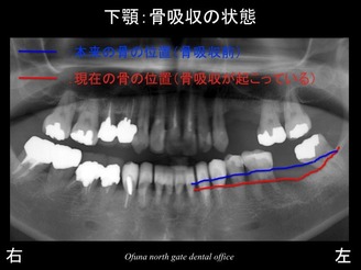 スライド13