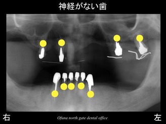 スライド03