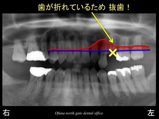 スライド08