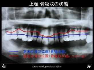 スライド08