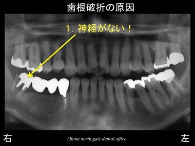 スライド06