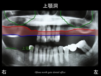 スライド05