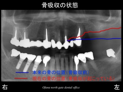 スライド03