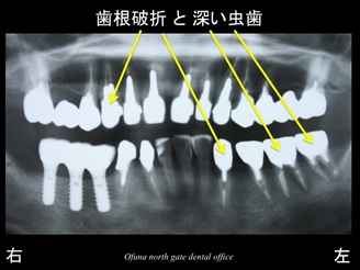 スライド05