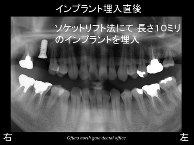 スライド09