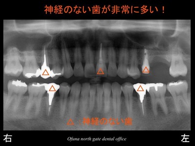 スライド06