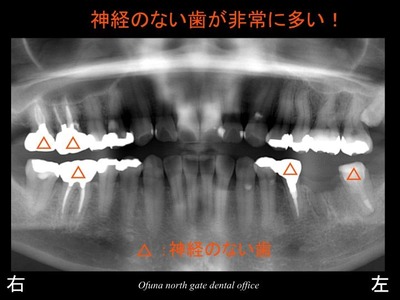 スライド05