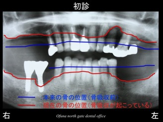 スライド08