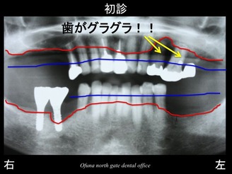 スライド09