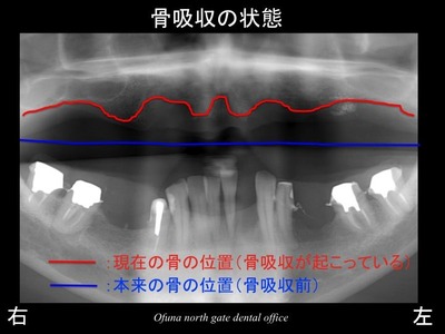 スライド08