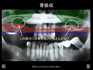 スライド07