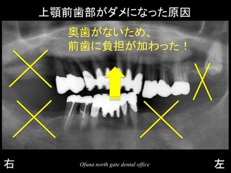 スライド07