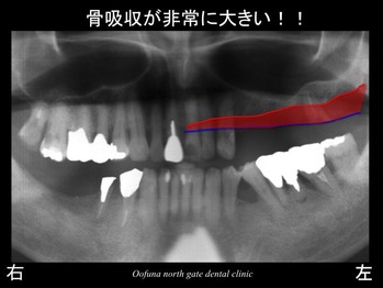 スライド03