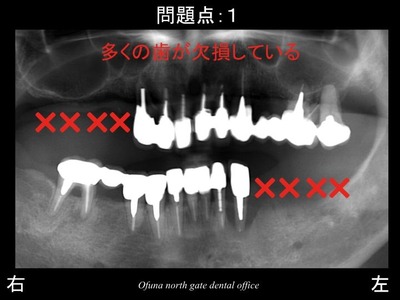 スライド04