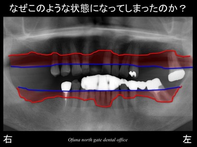 スライド09