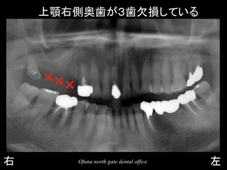 スライド02