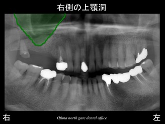 スライド04