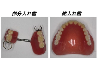 義歯形態