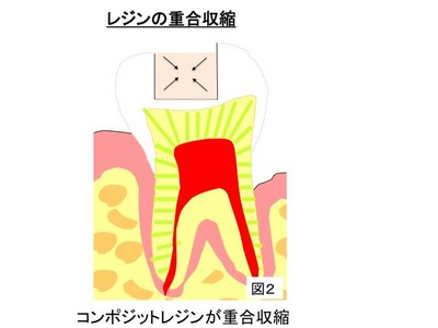 CR図２