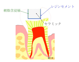 セラミック