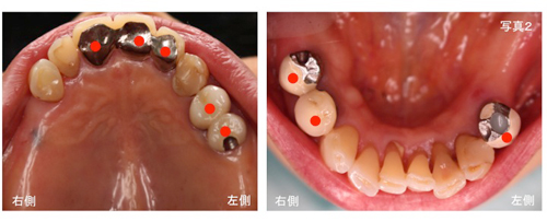 治療計画