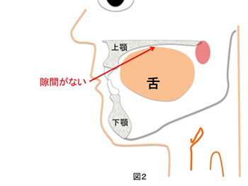 これは口臭が起こりにくい状態