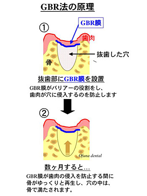 GBR法の原理