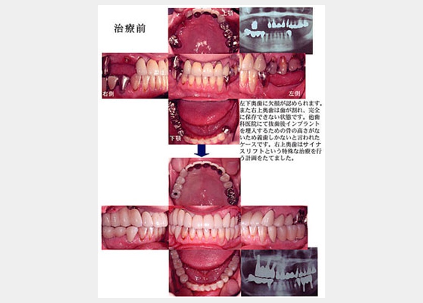 治療法2