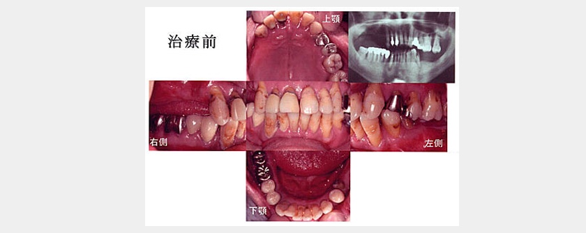 治療前