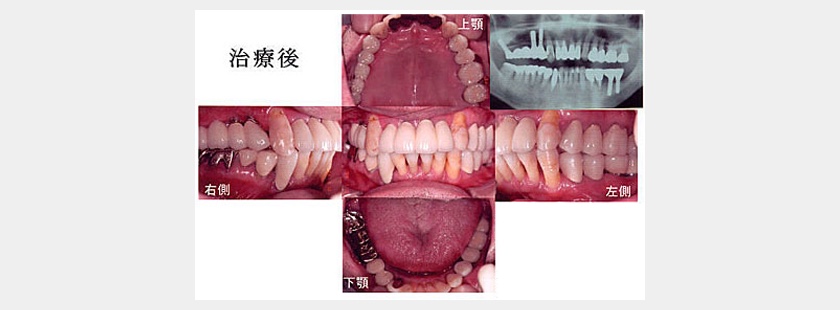 治療後