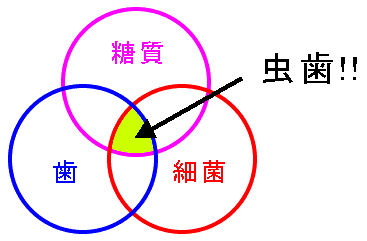 虫歯の仕組みイメージ