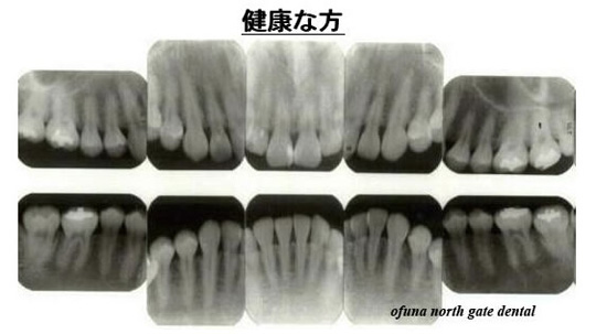 健康な方の写真