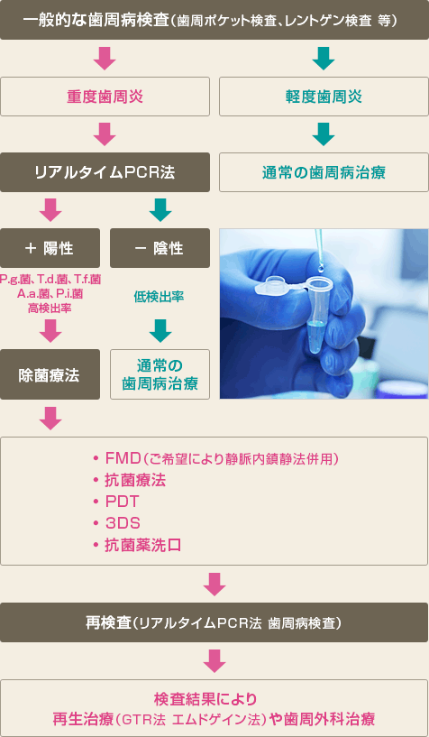 治療ステップ