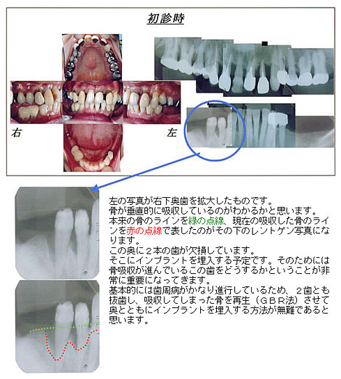 初診時写真