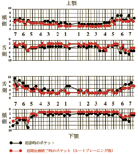 初期治療終了後の歯周ポケット再検査