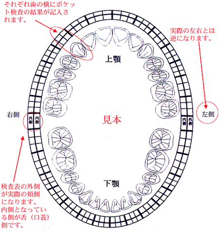 診査表