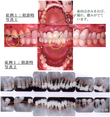 症例1：初診時写真1、症例3：初診時写真2