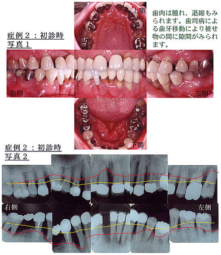症例2：初診時写真1、症例3：初診時写真2